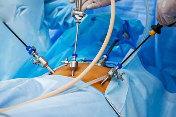 Best Advance Laparoscopic Surgeon in Pune:|Best Laparoscopic surgery in Undri, Pune|Dr. Narendra Chopde