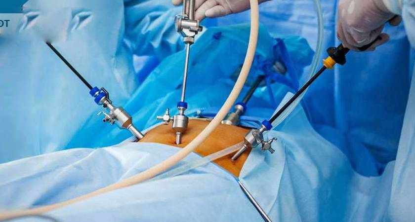Best Advance Laparoscopic Surgeon in Pune:|Best Laparoscopic surgery in Undri, Pune|Dr. Narendra Chopde